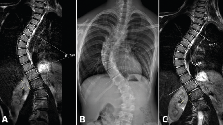 Diferencia entre radiografía y tomografía computarizada